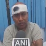 Delhi: GTB अस्पताल में गाली-गलौज, मारपीट… सीनियर डॉक्टर का सिर फोड़ा, हमलावरों में से एक ने खुद के बताया ASI