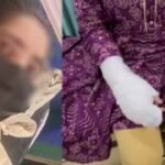 दिल्ली एसिड अटैक में नया मोड़: पीड़ित के पिता पर आरोपी की पत्नी ने लगाए गंभीर आरोप, बोली-मेरे साथ दुष्कर्म हुआ