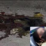 Acid Attack: बाप की साजिश… बेटी ने खुद पर छिड़का तेजाब? एसिड अटैक की कहानी में इन सवालों से आया नया ट्विस्ट